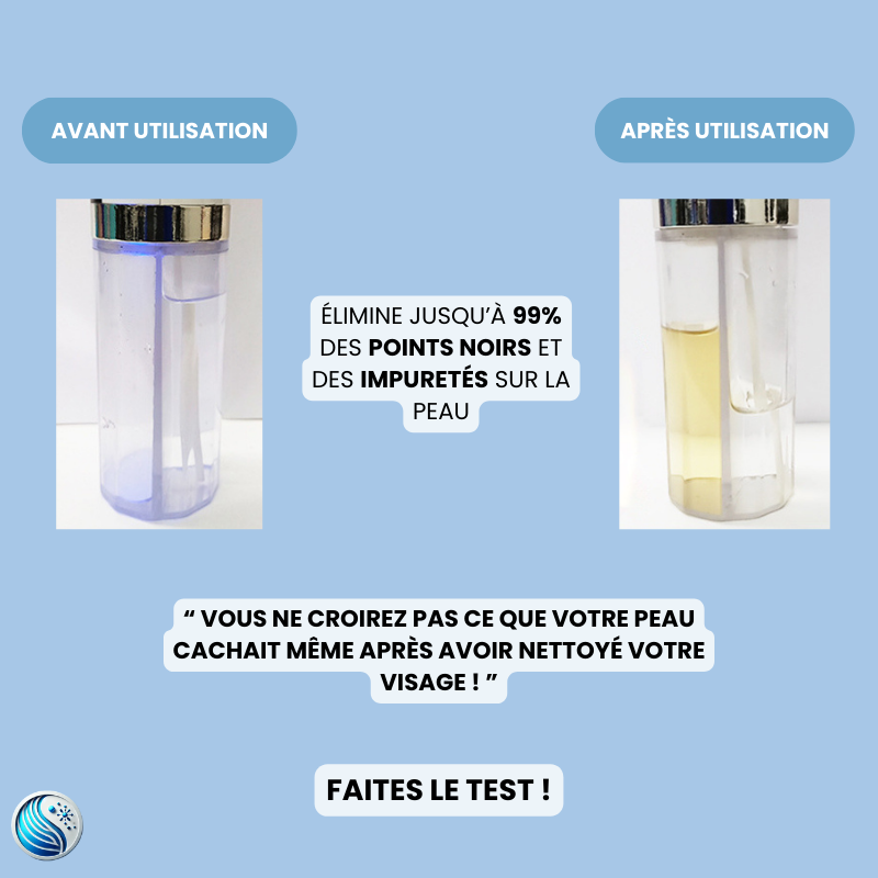 HydroPure by Skinova - Le Nettoyeur Visage à Hydrodermabrasion