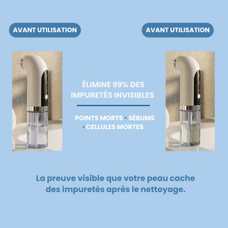 HydroPure™ - Aspirateur Points Noirs & Hydrodermabrasion Professionnel